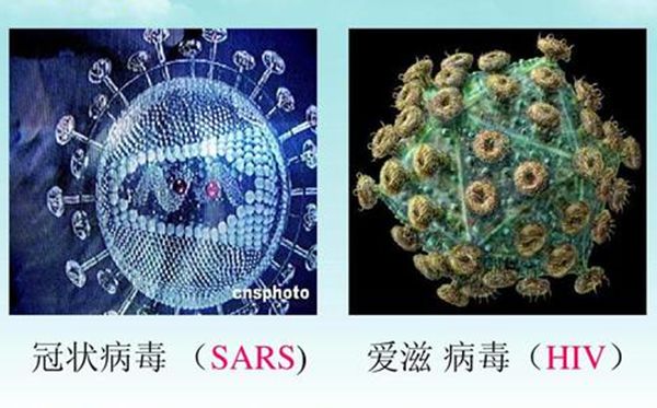 SARS冠狀病毒