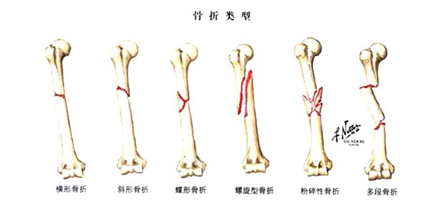 螞蟻莊園“寒潮橙色預(yù)警是什么等級(jí)
